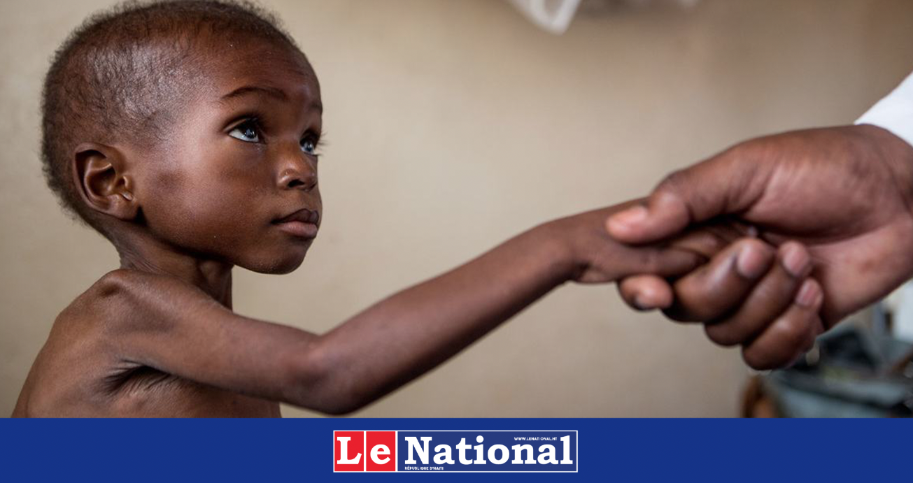 Sans l’aide américaine, l’ONUSIDA craint une « véritable pandémie du sida »